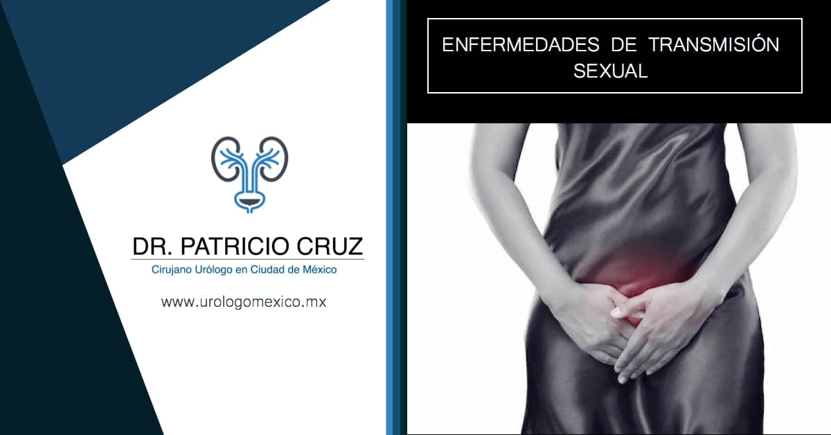 Enfermedades de Transmisión Sexual ETS Cirujano Urólogo México